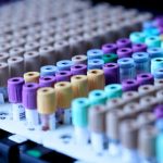 Close-up of various laboratory sample tubes arranged on a tray