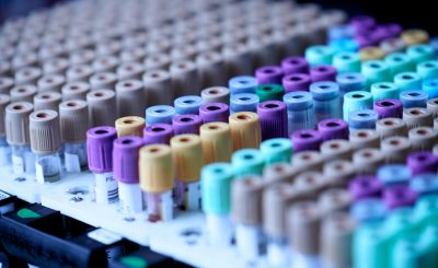 Close-up of various laboratory sample tubes arranged on a tray