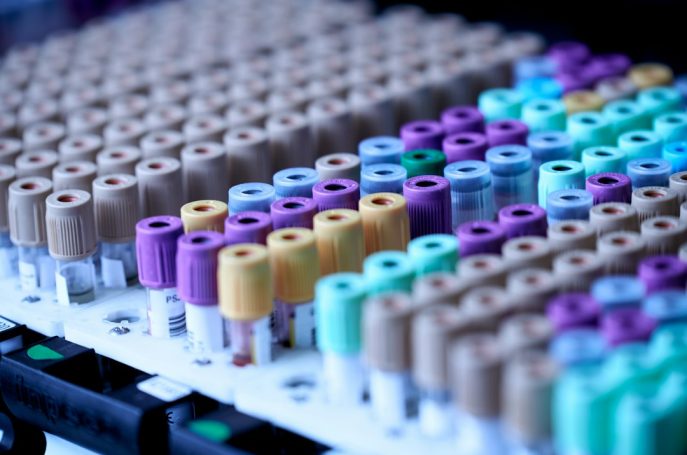 Close-up of various laboratory sample tubes arranged on a tray