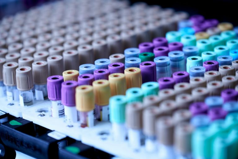 Close-up of various laboratory sample tubes arranged on a tray